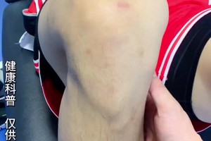 职业篮球运动员的休息与恢复技巧:提升表现的关键